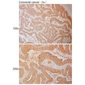 Solarbio K110995P Anti-WSCD2 Polyclonal Antibody