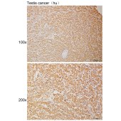 Solarbio K111117P Anti-RNF19A Polyclonal Antibody