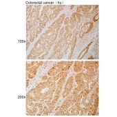Solarbio K110832P Anti-HSD17B4 Polyclonal Antibody