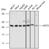 Solarbio K110991P Anti-AKT2 Polyclonal Antibody