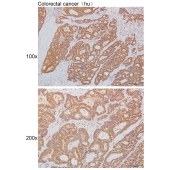 Solarbio K111471P Anti-CYP4B1 Polyclonal Antibody