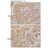 Solarbio K111243P Anti-TMLHE Polyclonal Antibody