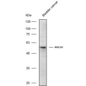 Solarbio K110995P Anti-WSCD2 Polyclonal Antibody