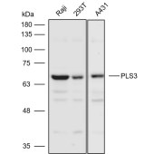 Solarbio K110614P Anti-PLS3 Polyclonal Antibody