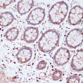 Solarbio K009986P Anti-S100A5 Polyclonal Antibody