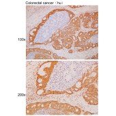 Solarbio K111722P Anti-ITLN1 Polyclonal Antibody