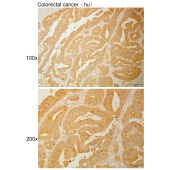 Solarbio K111061P Anti-JMY Polyclonal Antibody