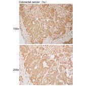 Solarbio K111967P Anti-SPAG5 Polyclonal Antibody