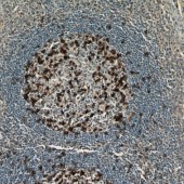 Solarbio K009917P Anti-PD-1/CD279 Polyclonal Antibody