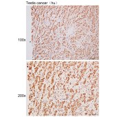 Solarbio K111733P Anti-MAGEA6 Polyclonal Antibody