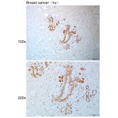 Solarbio K110823P Anti-HNRNPM Polyclonal Antibody