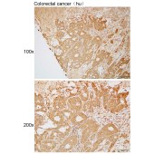 Solarbio K111975P Anti-B4GALT4 Polyclonal Antibody