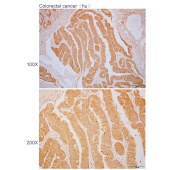 Solarbio K110591P Anti-UPK3B Polyclonal Antibody