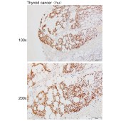 Solarbio K111491P Anti-MAP3K20 Polyclonal Antibody