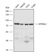 Solarbio K110836P Anti-EPS8L2 Polyclonal Antibody