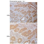 Solarbio K111123P Anti-SCARF2 Polyclonal Antibody