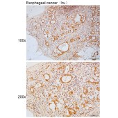 Solarbio K111762P Anti-SMOC1 Polyclonal Antibody