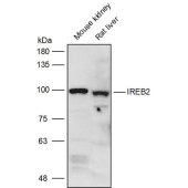 Solarbio K111419P Anti-IREB2 Polyclonal Antibody