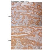 Solarbio K111002P Anti-PTK2B Polyclonal Antibody