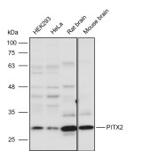 Solarbio K111602P Anti-PITX2 Polyclonal Antibody