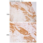 Solarbio K112103P Anti-ZBTB26 Polyclonal Antibody