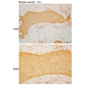 Solarbio K110536P Anti-DDX1 Polyclonal Antibody