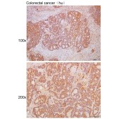 Solarbio K111731P Anti-VPS52 Polyclonal Antibody
