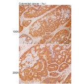 Solarbio K112109P Anti-MANF Polyclonal Antibody