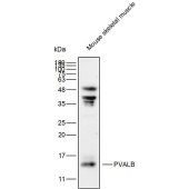 Solarbio K111911P Anti-PVALB Polyclonal Antibody