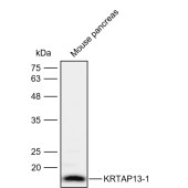Solarbio K112129P Anti-KRTAP13-1 Polyclonal Antibody