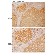Solarbio K111878P Anti-MAPK8IP1 Polyclonal Antibody