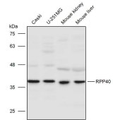 Solarbio K111450P Anti-RPP40 Polyclonal Antibody