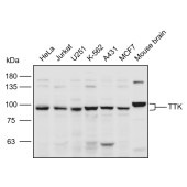 Solarbio K110574P Anti-TTK Polyclonal Antibody