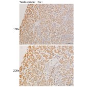 Solarbio K111250P Anti-ADCK1 Polyclonal Antibody