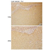 Solarbio K111003P Anti-FIGNL1 Polyclonal Antibody