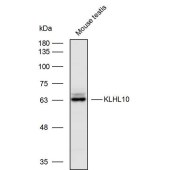 Solarbio K111702P Anti-KLHL10 Polyclonal Antibody