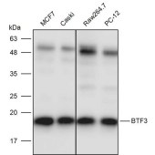 Solarbio K111414P Anti-BTF3 Polyclonal Antibody