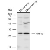 Solarbio K110586P Anti-PHF13 Polyclonal Antibody