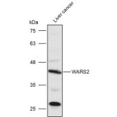 Solarbio K111235P Anti-WARS2 Polyclonal Antibody