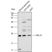 Solarbio K111656P Anti-ARL15 Polyclonal Antibody