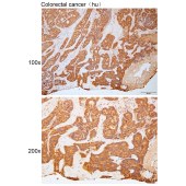 Solarbio K111797P Anti-AGO2 Polyclonal Antibody