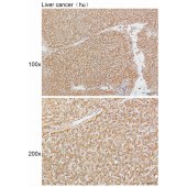 Solarbio K111625P Anti-AurB/C Polyclonal Antibody