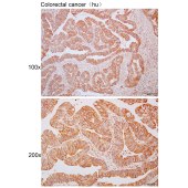 Solarbio K110612P Anti-ADAT1 Polyclonal Antibody