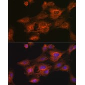 Solarbio K009952P Anti-RSPO1 Polyclonal Antibody