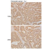 Solarbio K111225P Anti-AP1G2 Polyclonal Antibody