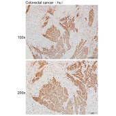 Solarbio K111964P Anti-ETFA Polyclonal Antibody
