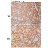 Solarbio K110990P Anti-FASTKD2 Polyclonal Antibody