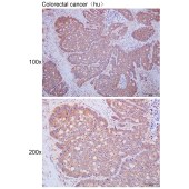 Solarbio K111680P Anti-SEC31A Polyclonal Antibody