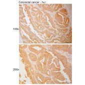 Solarbio K111037P Anti-CRISPLD2 Polyclonal Antibody