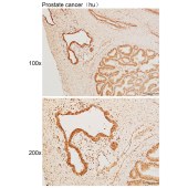 Solarbio K111491P Anti-MAP3K20 Polyclonal Antibody